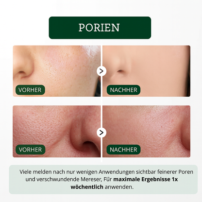 Rice Peel Glow Serum